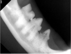 X-ray of left lower premolars