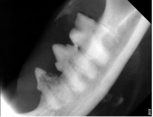X-ray of right lower premolars